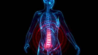 Lumbar, belkemiğinin düşük kısmı X-ray gövdesinde, ilaç 3 boyutlu animasyon