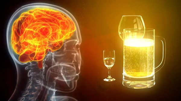 brain stricken by drinks, cg medicine 3d illustration