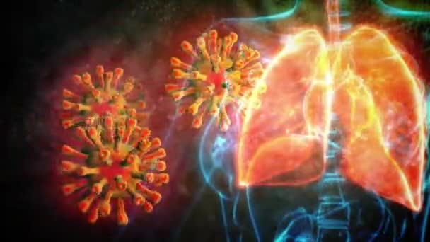 Ιατρική Animation Ανθρώπινα Προβλήματα Των Πνευμόνων Του 2019 Ncov — Αρχείο Βίντεο