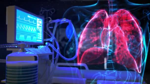 Pulmones Uci Respirador Pulmonar Animación Médica — Vídeos de Stock