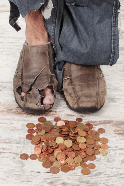 Poor feet — Stock Photo, Image