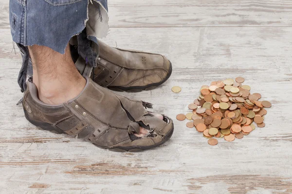 Poor feet — Stock Photo, Image