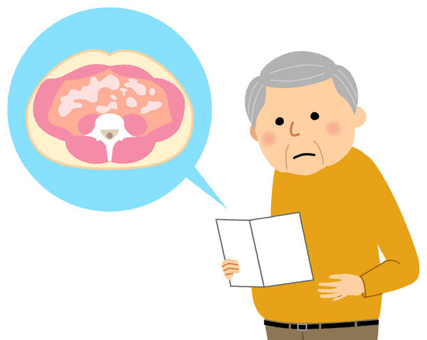 Пожилые люди с висцеральным ожирением / Это иллюстрация пожилого человека с висцеральным ожирением жира.