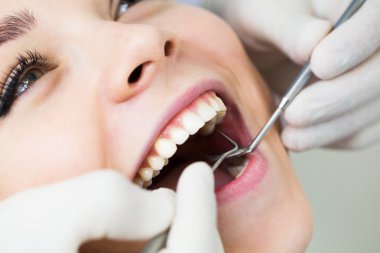 Dişçide ağız muayenesi sırasında ağzı açık bir kadının yakın çekimi.