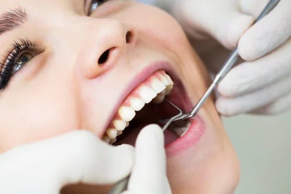 Primer plano de la mujer con la boca abierta durante el chequeo oral en el dentista Fotos De Stock Sin Royalties Gratis