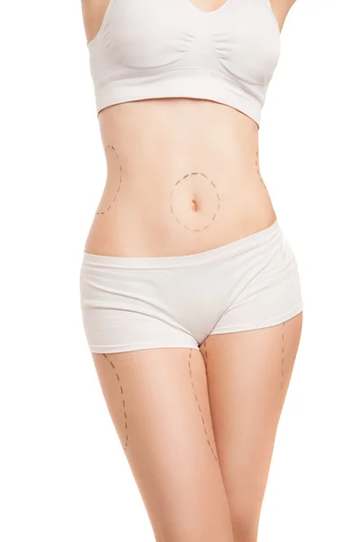 Donna irriconoscibile in biancheria intima con contorni di liposuzione — Foto Stock