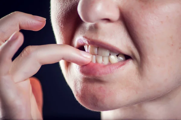 Kvinde Nibbles Negle Når Føles Stress Eller Nervøs Mennesker Dårlige - Stock-foto