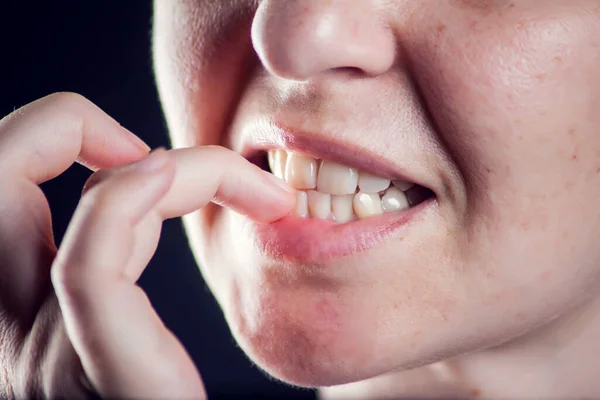 Kvinde Nibbles Negle Når Føles Stress Eller Nervøs Mennesker Dårlige - Stock-foto