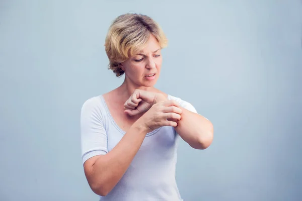 Mulher Coçando Uma Coceira Fundo Branco Pele Sensível Sintomas Alergia — Fotografia de Stock