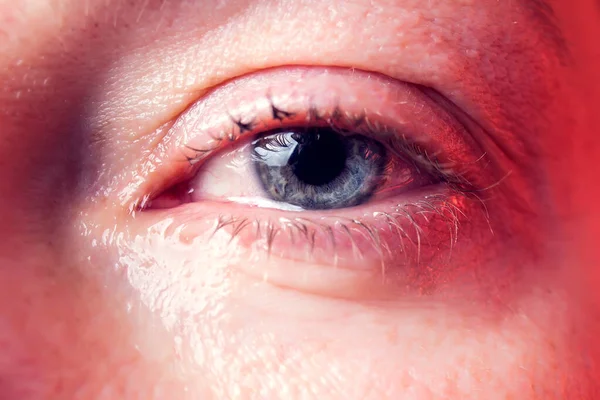 Close Blue Eye Woman Tear People Emotions Concept — 图库照片