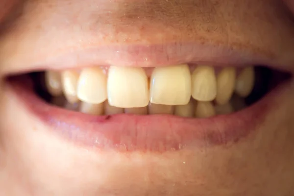 Beyaz Arka Planda Sağlıklı Dişleri Olan Güzel Genç Bir Kadın — Stok fotoğraf