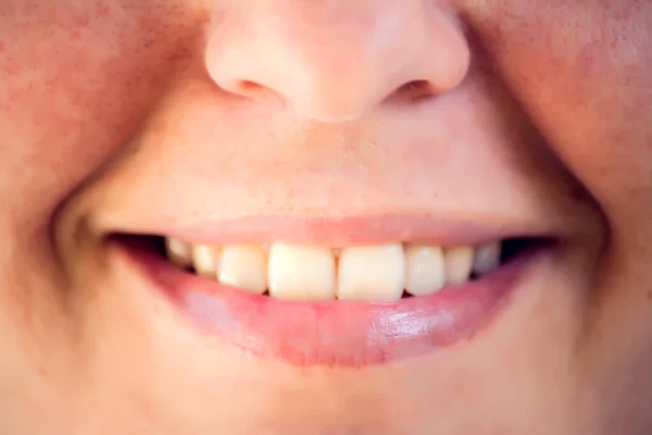 Beautiful Young Woman Healthy Teeth White Background Close Shot Healthcare - Stock-foto