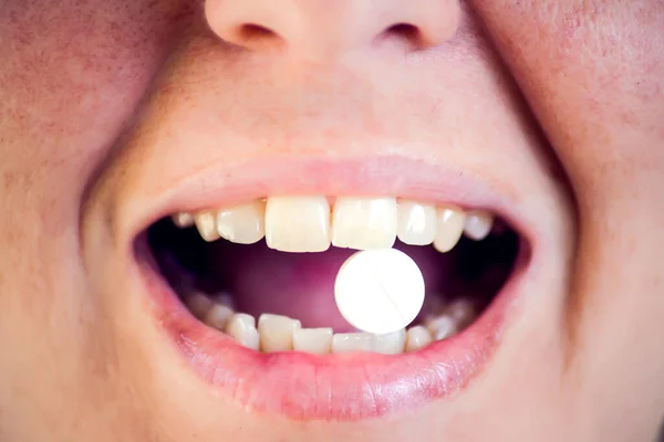 Ağzını Dilinde Ilaç Hapını Tut Laç Alan Bir Kadın Sağlık — Stok fotoğraf
