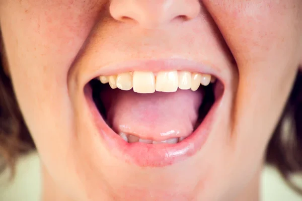 Beyaz Arka Planda Sağlıklı Dişleri Olan Güzel Genç Bir Kadın — Stok fotoğraf