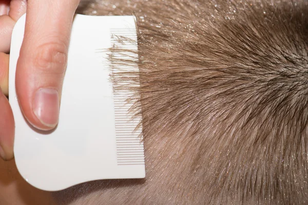 Searching for lice on a childs head — Stock Photo, Image