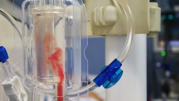 Dialys maskin blod fyllning — Stockvideo