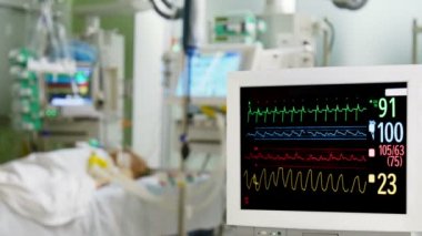 Hastane EKG monitör