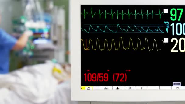 Мониторинг кардиограммы пациента — стоковое видео