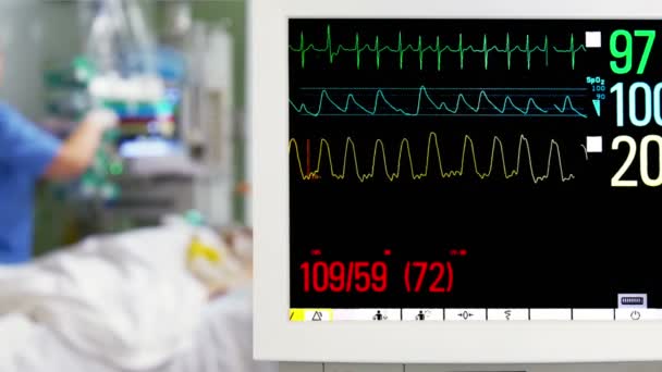 Patient Cardiogram Monitoring — Stock Video