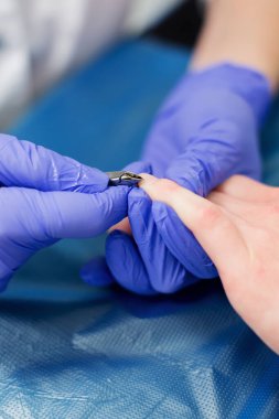 Manikür prosedürü. Manikürcü müşterinin tırnaklarını inceler, burunlarını ve tırnak etlerini uçlarından ayırır. Seçici odak.