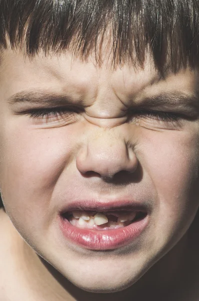 Criança mostra dentes desaparecidos — Fotografia de Stock