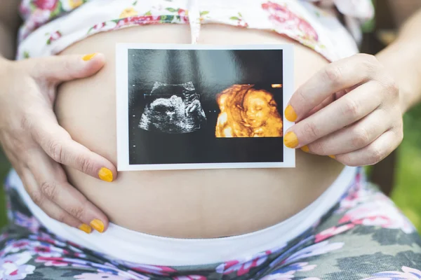 Zwangere vrouw met afbeelding van schoot — Stockfoto