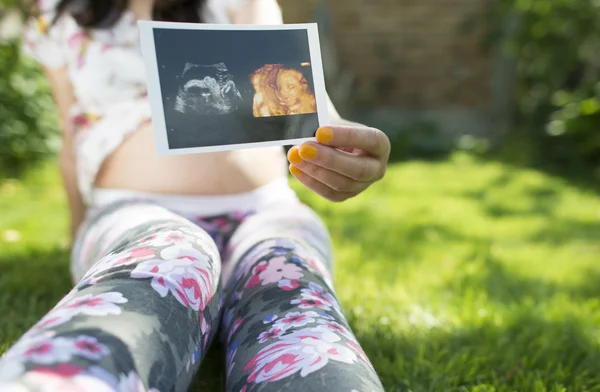 Mulher grávida segurar foto do útero — Fotografia de Stock
