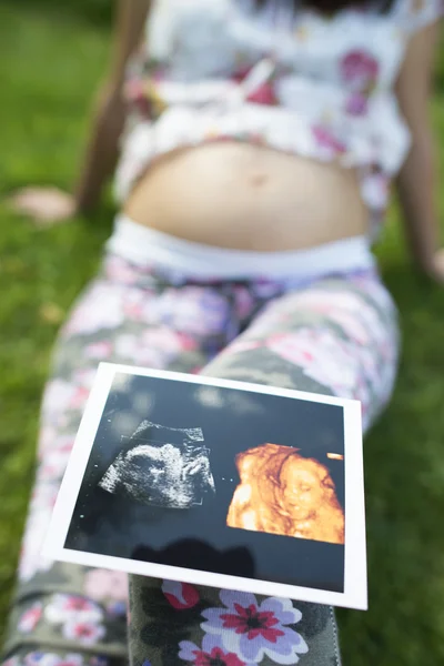 Mulher grávida segurar foto do útero — Fotografia de Stock