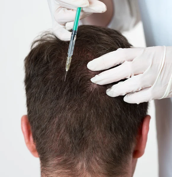 Un hombre guapo recibe una inyección en la cabeza. Concepto de Mesoterapia . — Foto de Stock
