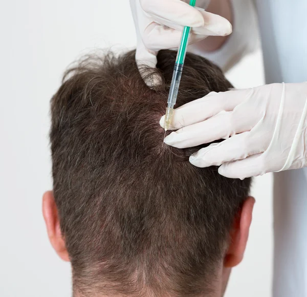 Um homem bonito está a receber uma injecção na cabeça. Conceito de Mesoterapia . — Fotografia de Stock