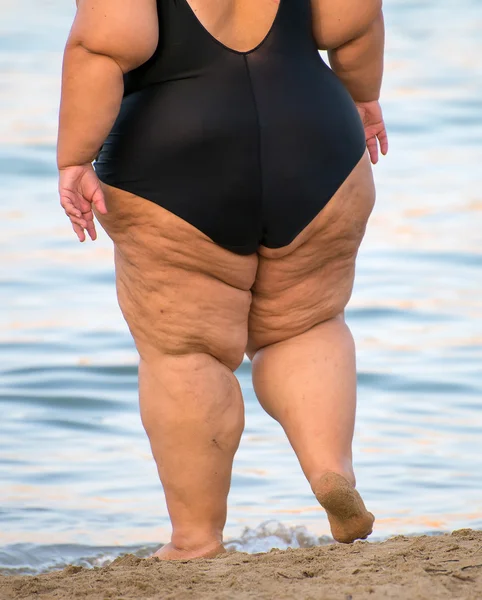 Übergewichtige Frau am Strand. Unerkennbare Person. — Stockfoto