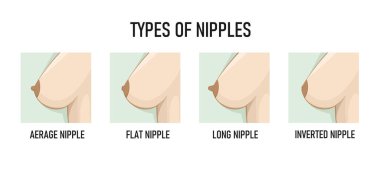 Meme ucu tipleri. Vektör illüstrasyonu