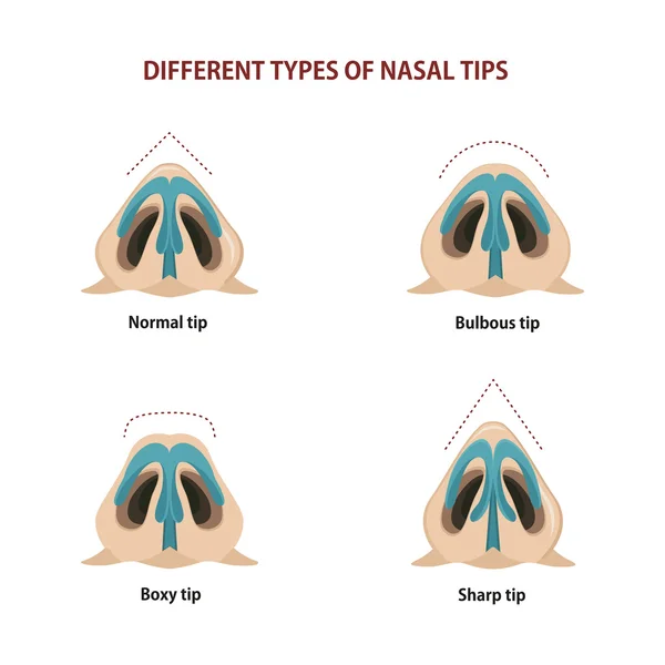 Olika typer av nasal tips — Stock vektor