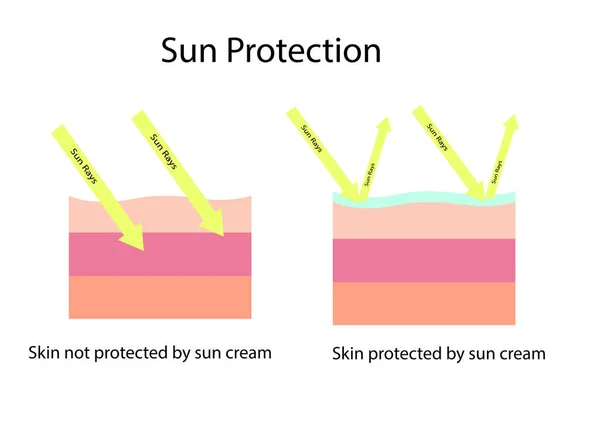 피부와 넓은 스펙트럼의 선크림을 비교하여 UVA 와 UVB 를 보호하고 UVA 를 보호하지 못하는 일반적 인 선크림을 보호 한다 — 스톡 벡터