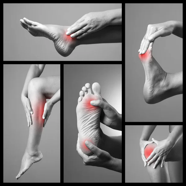 Pain in the foot. Massage of female feet. Sore on woman legs. Pain in the human body on a gray background. Collage of body parts of several photos — Stock Image Pain in the foot. Massage of female feet. Sore on woman legs. Pain in the human body on a gray background. Collage of body parts of several photos Stock Photo