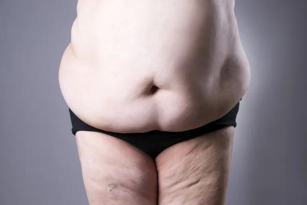 Obesità corpo femminile, donna grassa pancia da vicino — Foto Stock