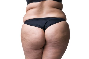 Selülit, yağlı kalça ve kalça ile şişman kadın bedeni