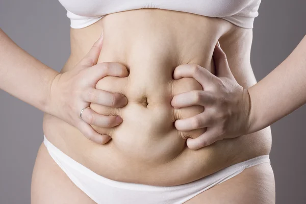 Obesità corpo femminile, donna grassa pancia da vicino — Foto Stock