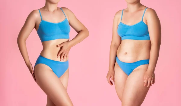 Vrouw Lichaam Voor Gewichtsverlies Roze Achtergrond Plastische Chirurgie Concept — Stockfoto