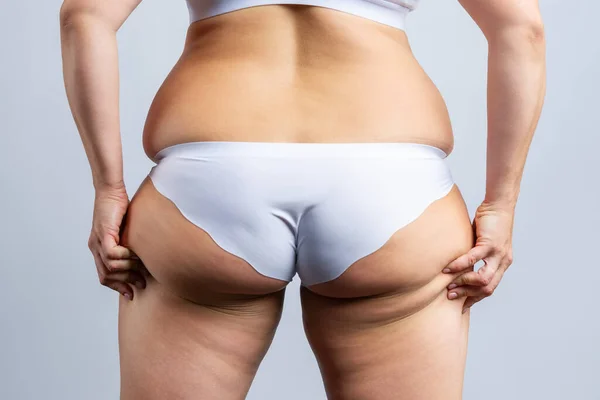 Overweight woman with fat hips and buttocks, obesity female body on gray background, studio shot