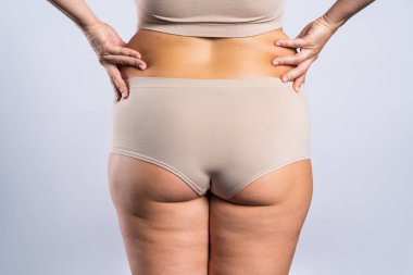 Şişman kalçaları ve kalçaları olan şişman bir kadın, gri arka planda obez bir kadın vücudu, stüdyo çekimi.