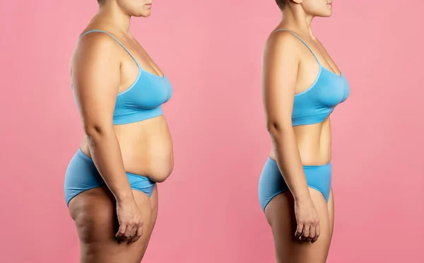 Cuerpo Mujer Antes Después Pérdida Peso Sobre Fondo Rosa Concepto —  Fotos de Stock