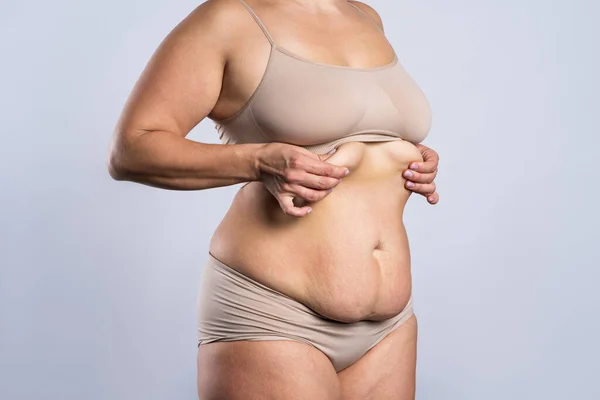 Tummy tuck, flabby skin on a fat belly, plastic surgery concept on gray background