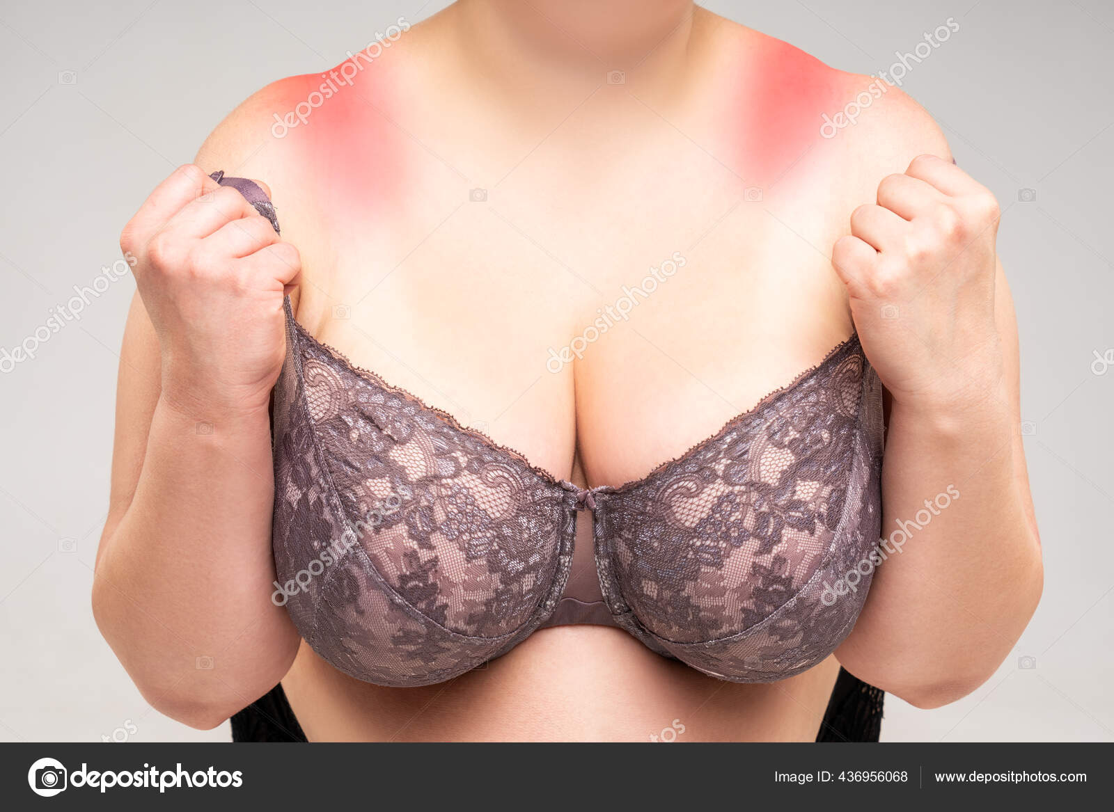 Old Woman With Irritated Skin Under Bra, Irritation On The, 41% OFF