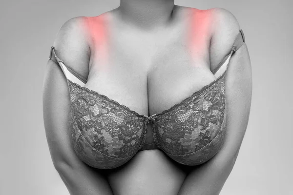 Fat woman with irritated skin under bra, irritation on the body from underwear, painful area highlighted in red