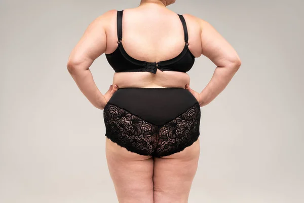 Overweight Woman Fat Hips Buttocks Obesity Female Body Gray Background — Stock Photo, Image