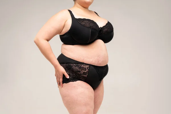 Fat woman in black lingerie, overweight female body on gray background, plastic surgery concept