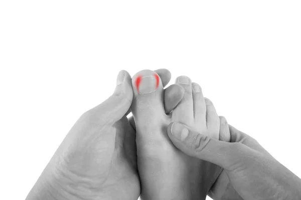 Ingrown Toenails Woman Foot Isolated White Background Pain Big Toe — Stock Photo, Image