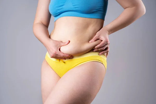 Tummy Tuck Zwiotczała Skóra Brzuchu Koncepcja Chirurgii Plastycznej Szarym Tle — Zdjęcie stockowe