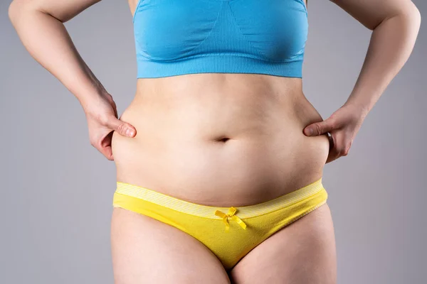Tummy tuck, flabby skin on a fat belly, plastic surgery concept on gray background